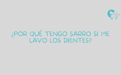 ¿Por qué tengo sarro si me lavo los dientes?