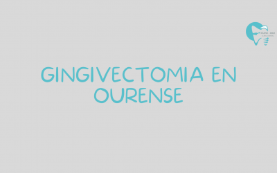 Gingivectomia en Ourense