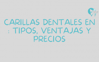 Carillas dentales en Ourense: tipos, ventajas y precios