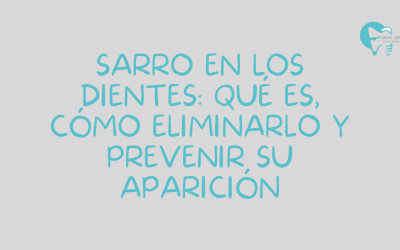 Sarro en los dientes: qué es, cómo eliminarlo y prevenir su aparición